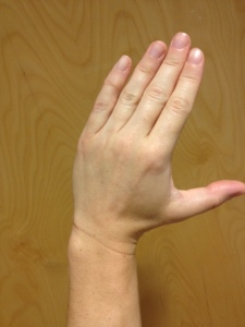 Radial Deviation (left hand)